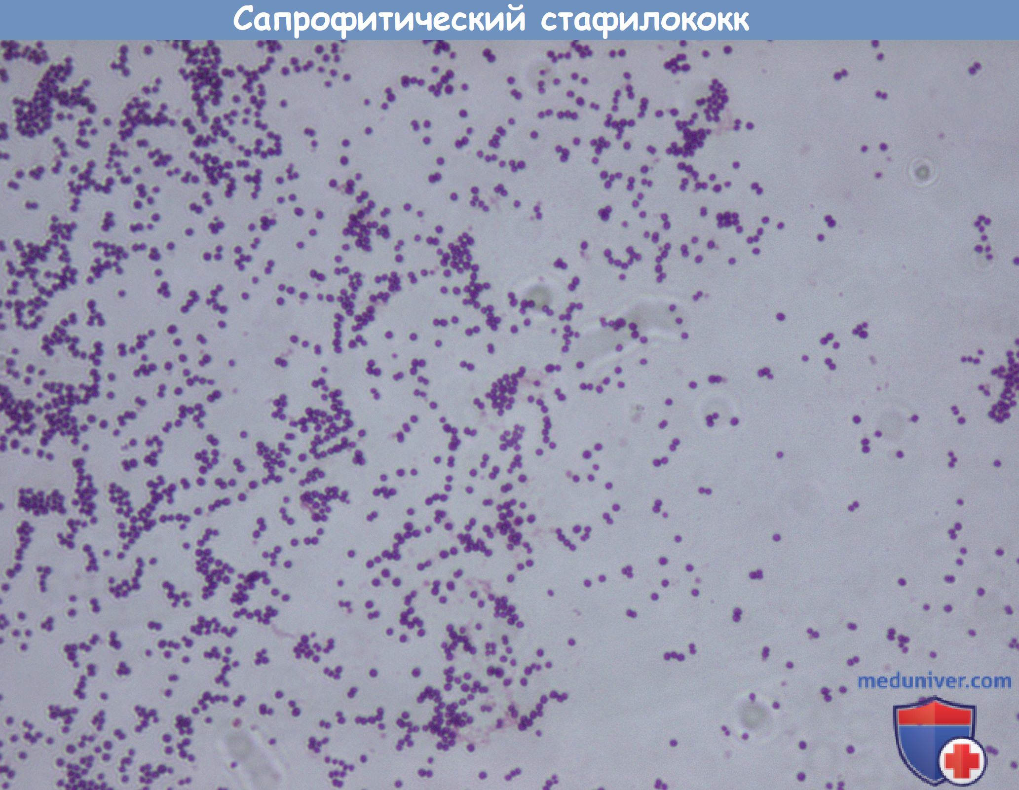  . Staphylococcus saprophyticus.   . 