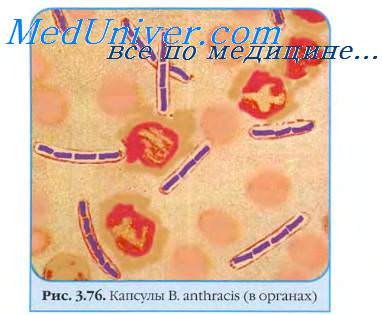   .  . Bacillus anthracis.   .      