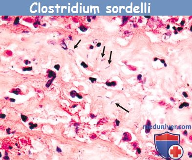 Clostridium sordelli. Clostridium fallax.  clostridium sordelli.  clostridium fallax. 