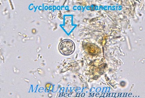   - Cyclospora cayetanensis