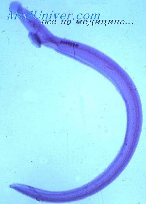   - Schistosoma japonicum
