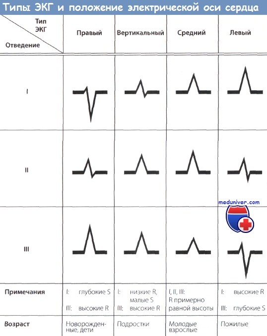 Типы и положение электрической оси сердца