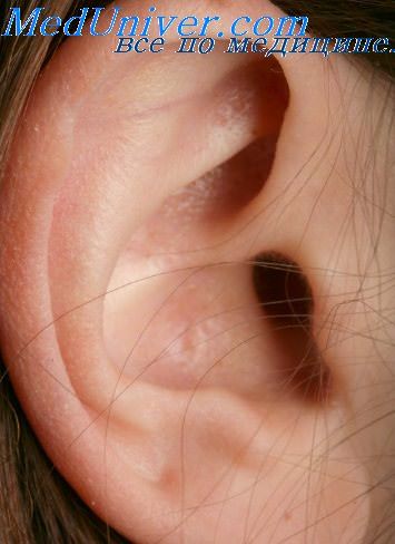 дерматит наружного слухового прохода