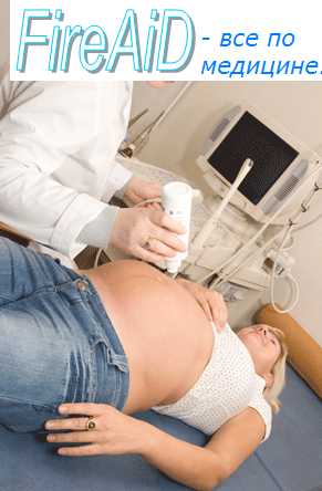 Переношенная беременность. Синдром Беллентайна-Рунге.