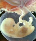 эмбрион человека