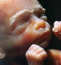 лицо эмбриона