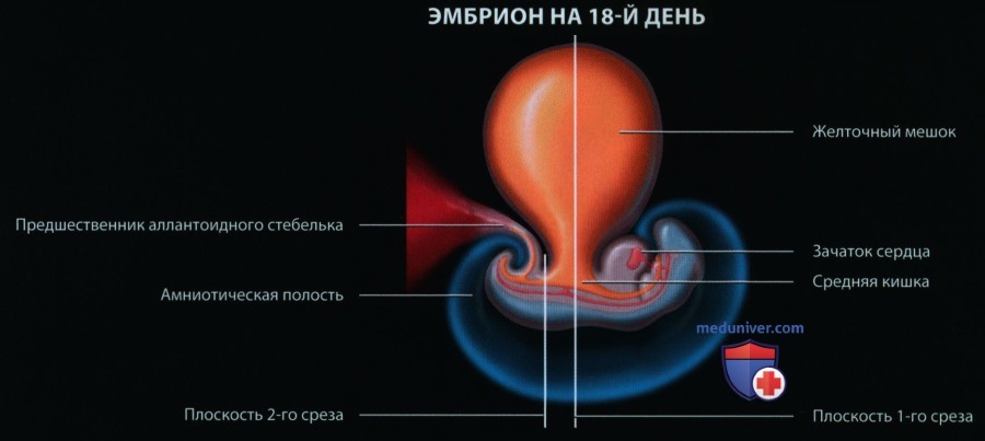 Эмбриогенез, лучевая анатомия передней брюшной стенки и желудочно-кишечного тракта (ЖКТ) у плода