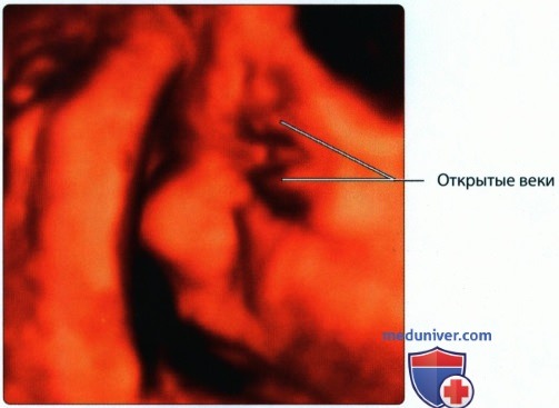 Эмбриогенез, лучевая анатомия лица и шеи плода