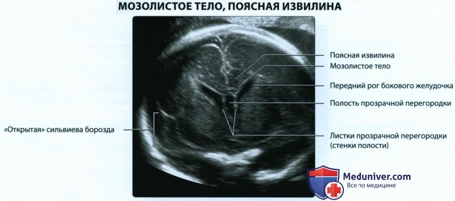 Эмбриогенез и анатомия головного мозга плода