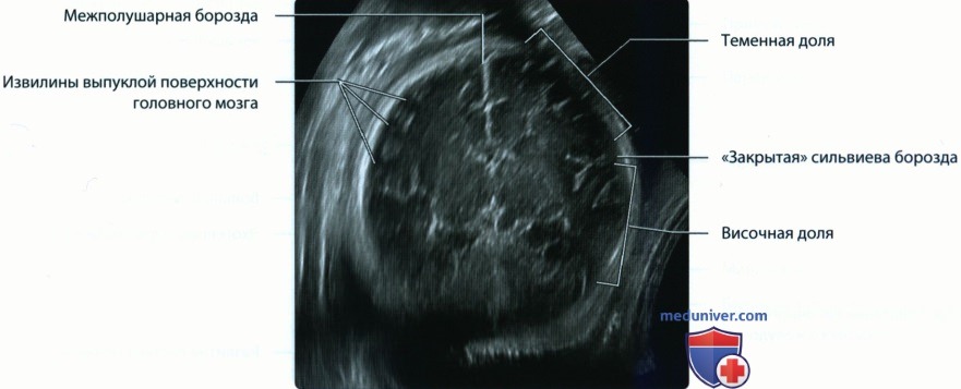 Эмбриогенез и анатомия головного мозга плода