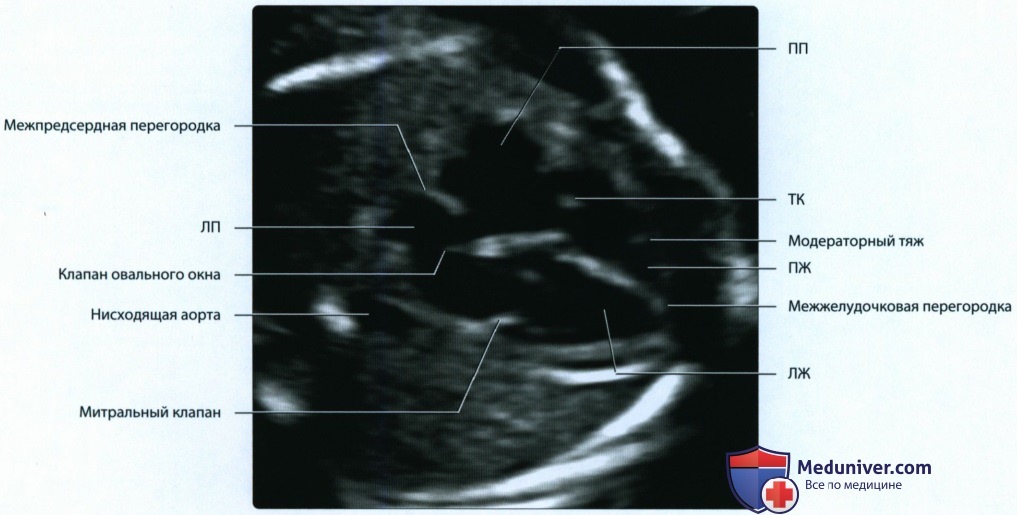 Эмбриогенез и лучевая анатомия сердечно-сосудистой системы у плода