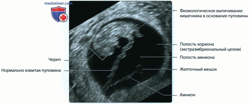 Эмбриология и анатомия плода в первом триместре