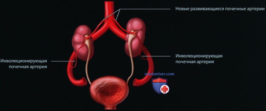 Эмбриогенез и лучевая анатомия мочеполовой системы у плода