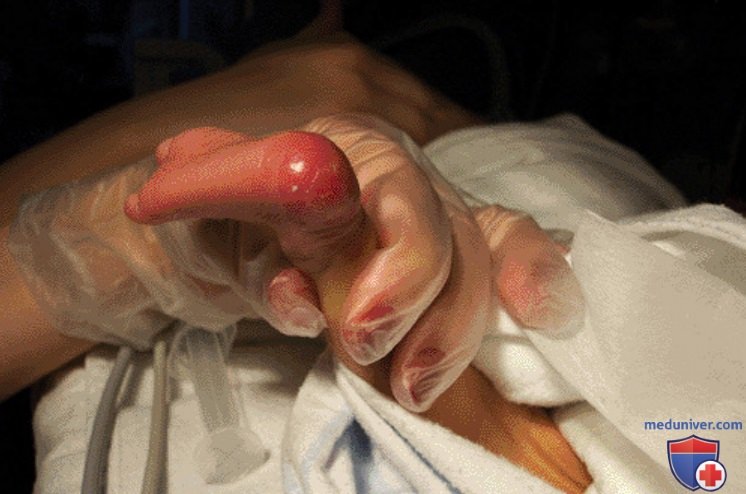 ���������� ����������������� ������ ������ ����� �� ����� � �������������