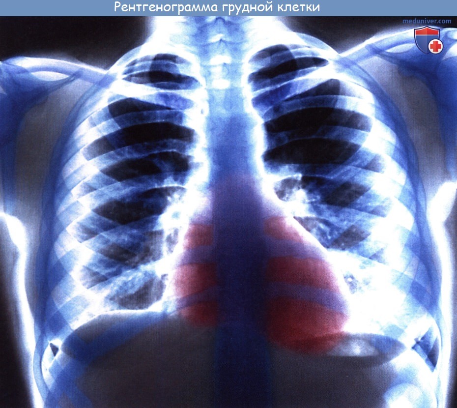 Анатомия: Рентгеноанатомия сердца. Контуры сердца