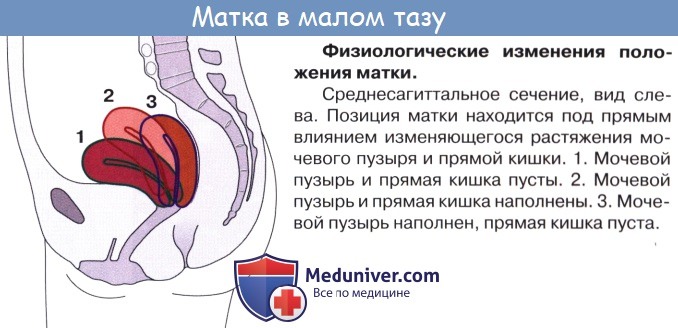 Анатомия: Матка. Стенки матки