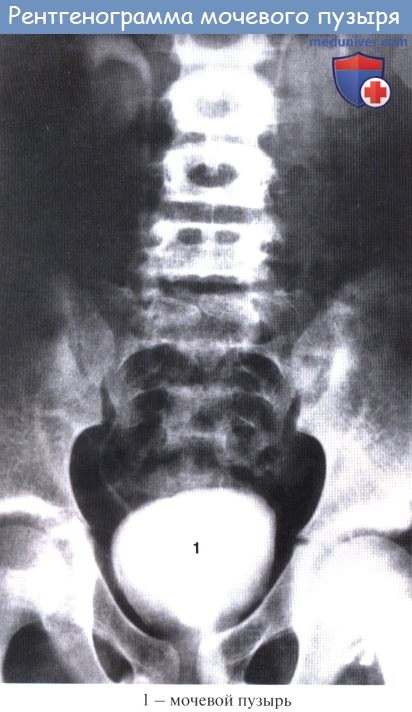 Анатомия: Лучевая анатомия почки (рентгенанатомия почки)