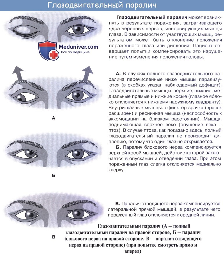 Анатомия: Вспомогательные органы глаза. Мышцы глазного яблока. Мышцы глаза