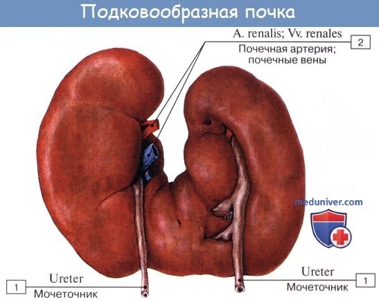 Анатомия: Почечная лоханка. Почечные чашки