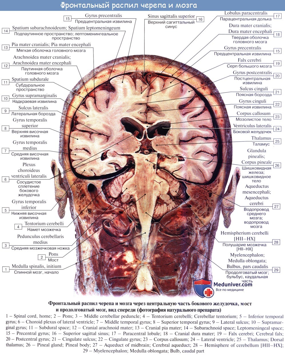 Отросток мозга 4. Намет мозжечка анатомия мрт. Артерии головного мозга кт анатомия. Анатомия головного мозга на мрт мозжечок. Отростки твердой мозговой оболочки головного мозга.