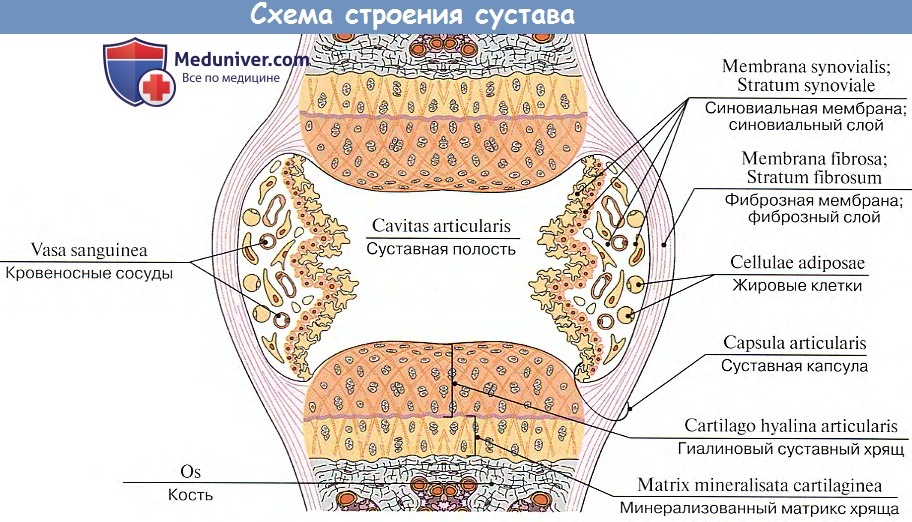Лечение болезни Гоффа (липоартрита коленного сустава) в Петрозаводске