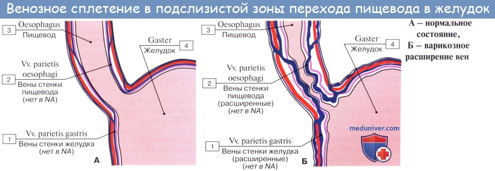 Анатомия: Портокавальные и кавокавальные анастомозы. Голова медузы