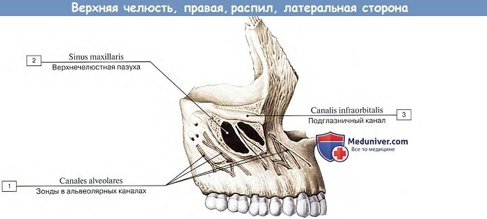 Анатомия: Верхняя челюсть, распил, латеральная сторона