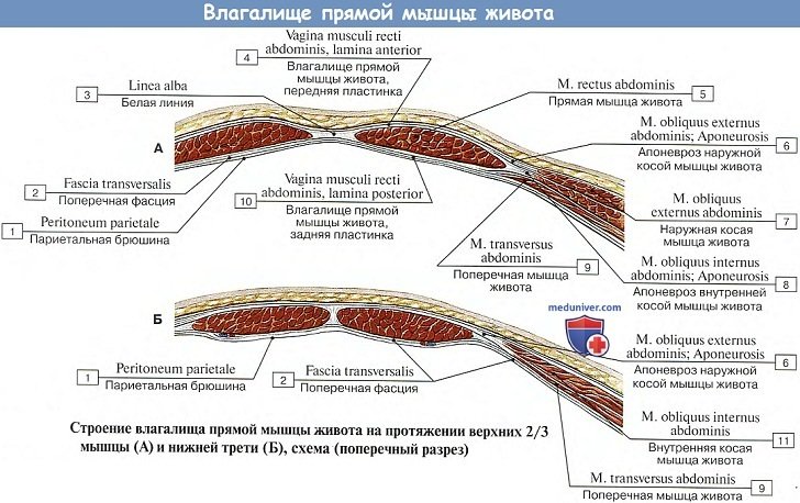 Анатомия: Влагалище прямой мышцы живота