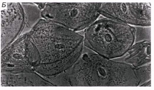 Клетки в световом микроскопе. Прокариоты и эукариоты.