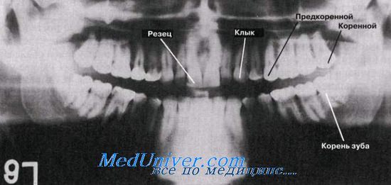 Зубной аппарат человека. Типы зубов. Общий план строения зуба