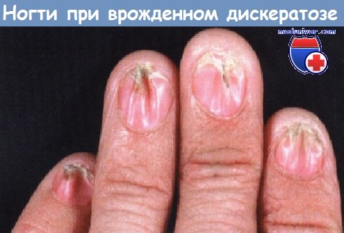 страница 2 | Фото Дистрофия ногтей, более 97 качественных бесплатных стоковых фото