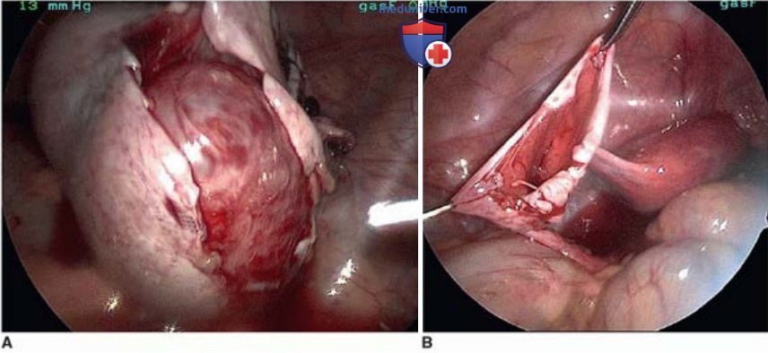 ������������� ������� ����������� ��������� � ����� � ����������