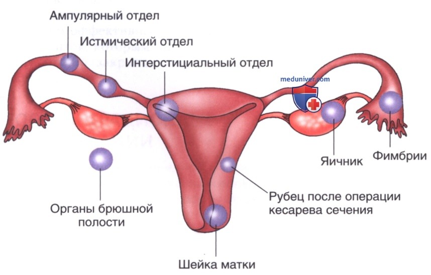 �������� ��� ����������� ������������