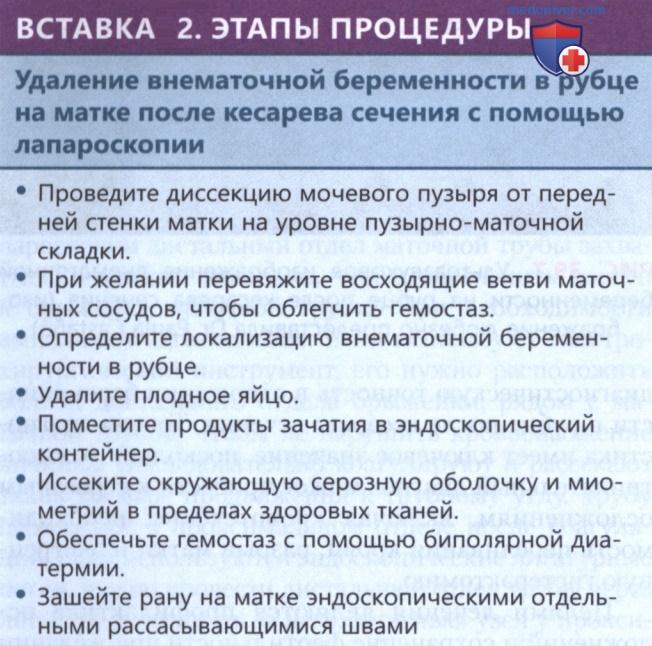 �������� ��� ����������� ������������
