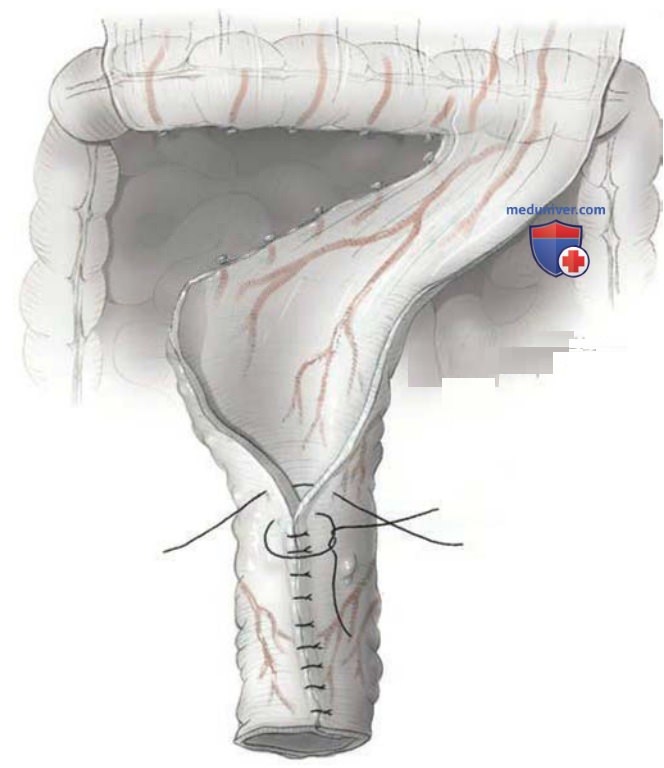 ������������� ��������� (������������)
