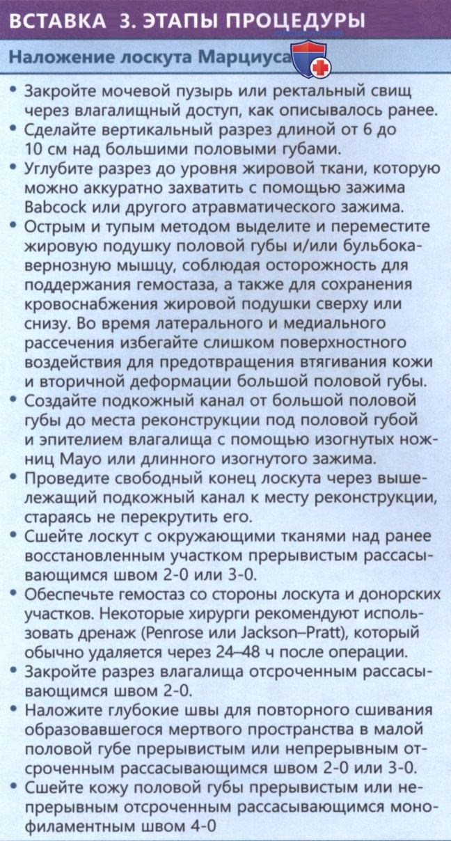�������� ��� ����� ������� ������ ������� �����