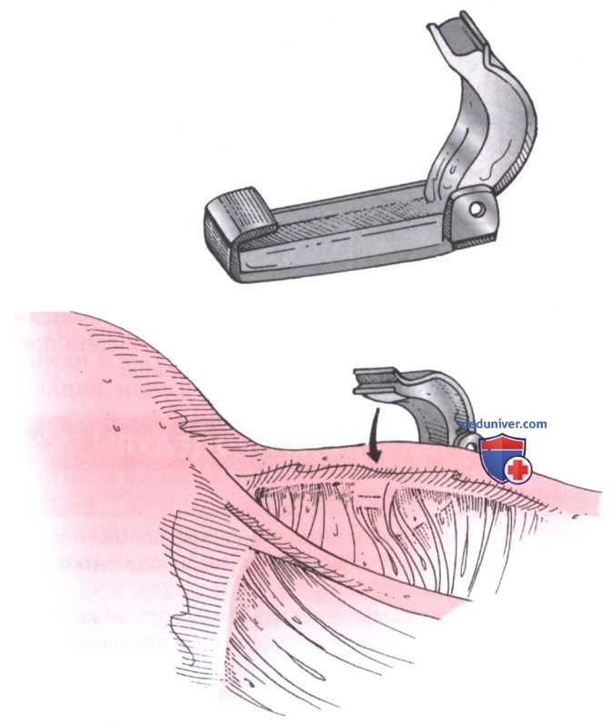 ������ ��������� �������� ���� (������� ������������) ����� ������������