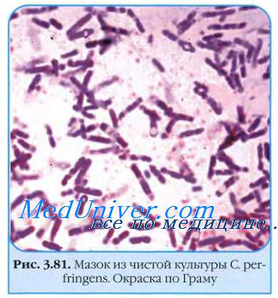 Clostridium perfringens. Термофилы. Бактерии рода Salmonella. Колифаги