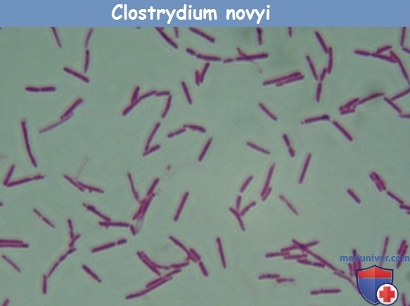Биохимические свойства clostridium novyi. Патогенность clostridium novyi. Прочие возбудители газовой ганрены
