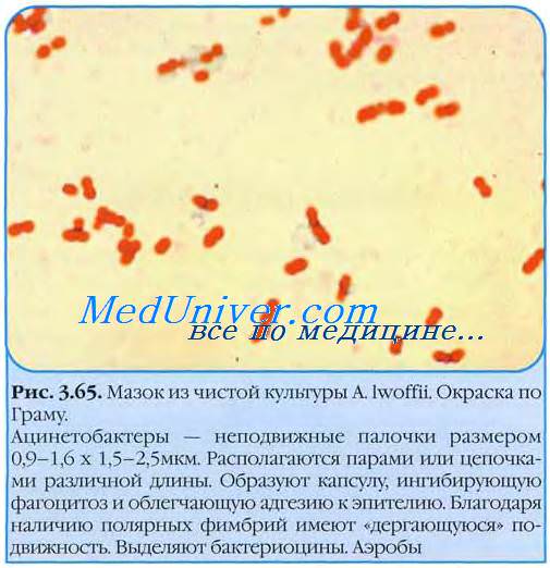 Бактериологическое исследование цнс. Бактериальные менингиты.