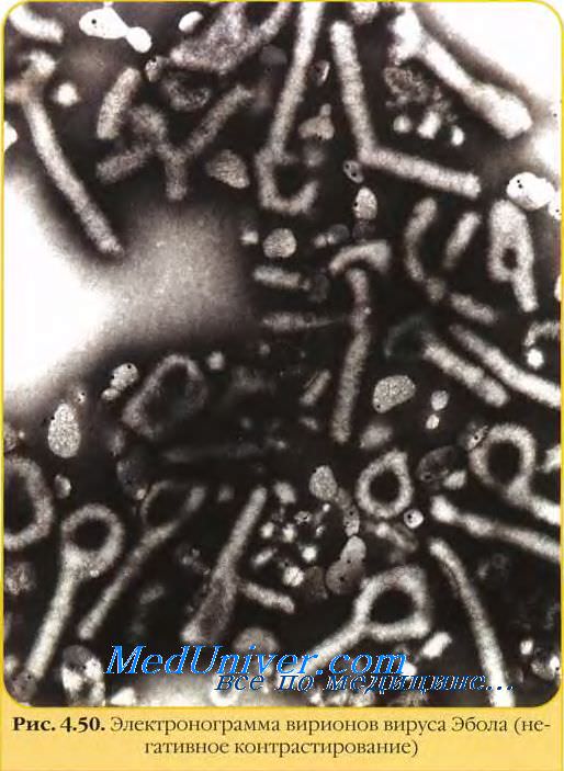 Филовирусы. Свойства филовирусов - строение вируса Лихорадки вируса Эбола