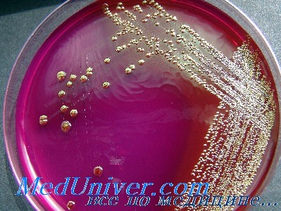  - Escherichia coli