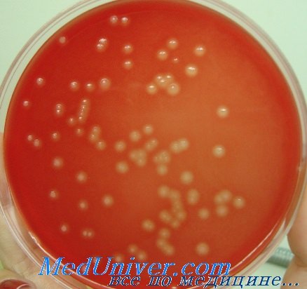   - Streptococcus agalactiae