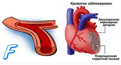 Токсико-резорбционный синдром. Дифференциальный диагноз острой ишемии миокарда ( оим, инфаркта миокарда ).