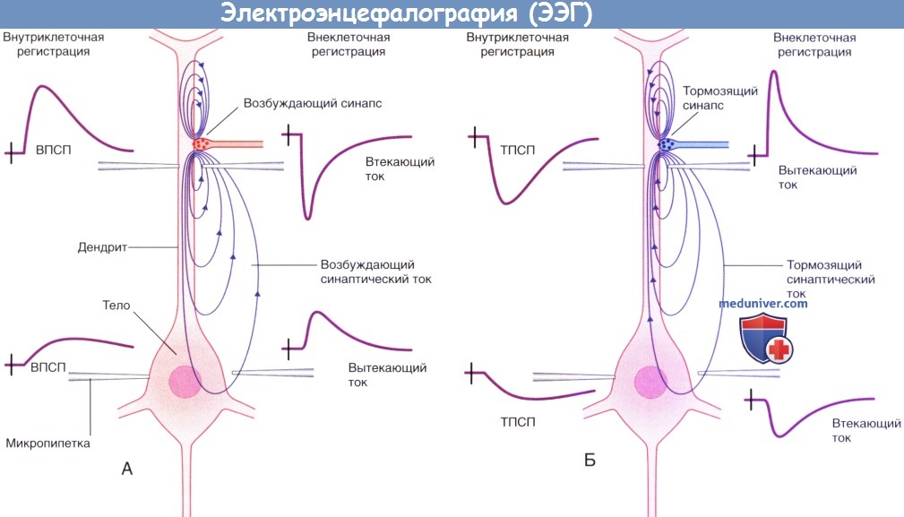 Электроэнцефалография (ЭЭГ)