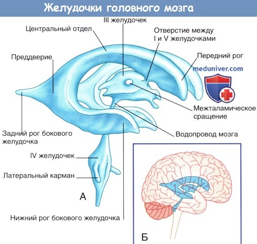 Желудочки головного мозга