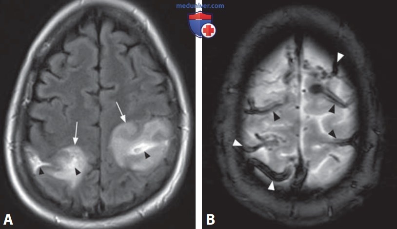 ��, ��� �������� ���������������� ��������� �������� ��������� �����