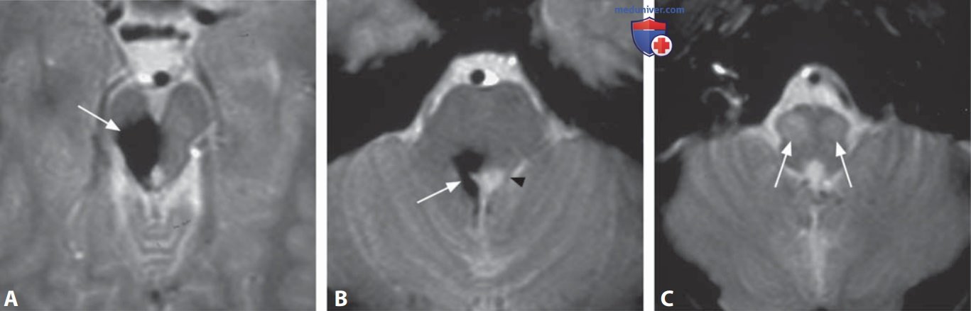 ��� �������� ���������������� ����������� ����