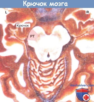 Крючок мозга и корково-спинномозговой проводящий путь (КСПП)