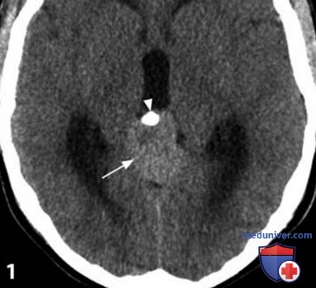 ��, ��� �������� ���������